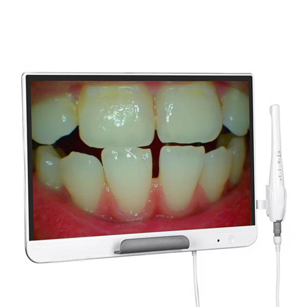 ECRAN AVEC ECRAN 19" AVEC CAMERA INTRABUCCALE SONZ