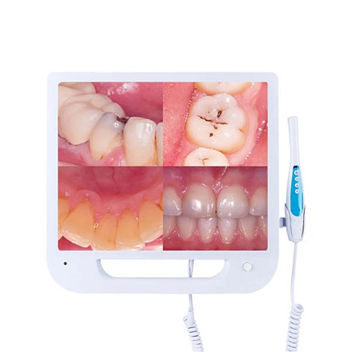 [DC.201] ECRAN AVEC CAMERA INTRABUCCALE SONZ CAM17